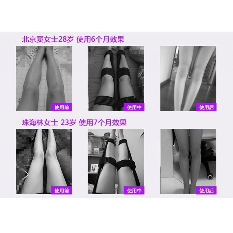 极速大腿外翻矫正器成人儿童宝y宝腿型矫正带O型腿X型矫正支架腿