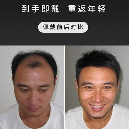 新品男士假发男h短发帅气韩版假发片头顶补发透气前额补发秃顶假
