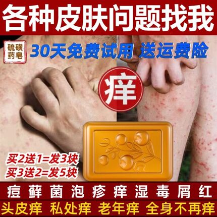 硫磺药皂杀菌止痒洗澡流黄皂抑菌除螨背后痘痘全身除虫满香皂