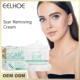Cream Remove Marks Fade Burn Repair Scars Old Scar Post Oper