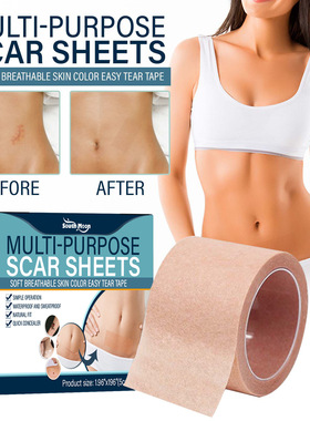 Skin concealer covers body birthmarks, scars, tattoos, spots