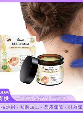 Keyou nevus cream gently cleans skin, smoothes skin, moistur