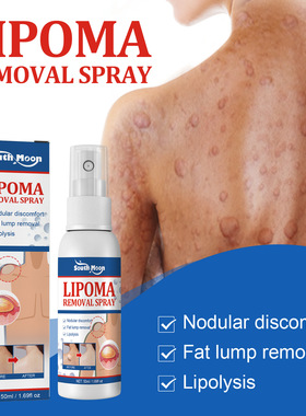 Fat knot spray relieves subcutaneous fat knot and body fat c