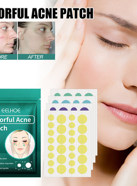 Colourful Acne StripsCleansing Facial ImpuritiesAcne Pimples
