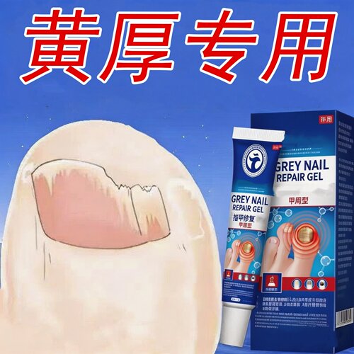 手脚甲趾药水安全无脱甲冰醋酸发黄发黑增厚男女通用官方正品