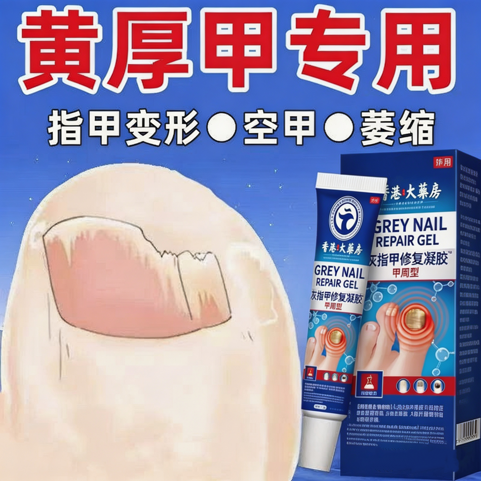 香港大药房手脚甲趾药水安全不疼痛无脱甲冰醋酸发黄发黑增厚正品