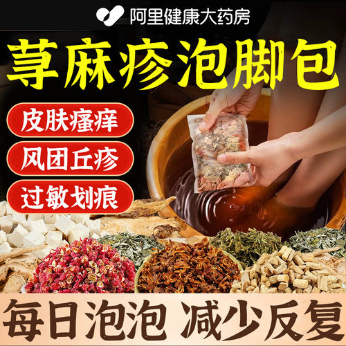 荨麻疹非中药泡澡的泡脚包慢性提高免疫力寻过敏风团性止痒断非根