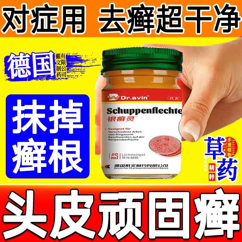 去头藓头癣药膏治头部头癣银屑癣真菌感染银屑灵膏特克星效药水zy