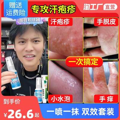 汗疱疹汗泡疱疹药膏汗孢疹去手上起小水泡手痒汗状疱疹湿疹止痒根