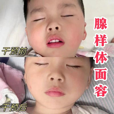 口呼吸矫正贴封口器闭嘴神器睡觉防张嘴嘴巴闭口封嘴唇贴闭合儿童