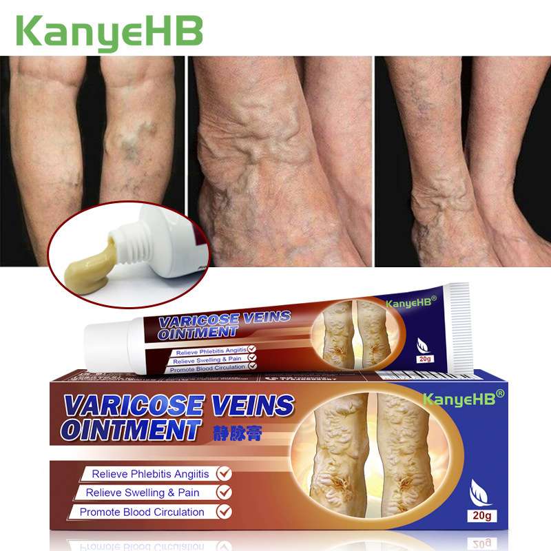 KanyeHB脉康膏静脉膏蚯蚓腿脉管液wishLazada