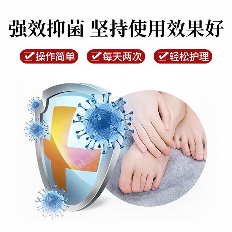 王泰林灰甲康护理液灰甲脚趾亮脱甲软甲卸甲草本皮肤抑菌液