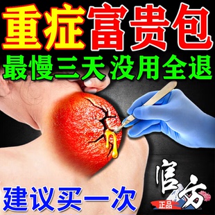 颈椎病富贵包消除贴正品 专用消除疏通按摩器肩颈酸肿压迫消特效药