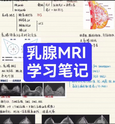 乳腺MRI学习笔记 乳腺解剖结构MRI常规序列解读 临床应用实例分析