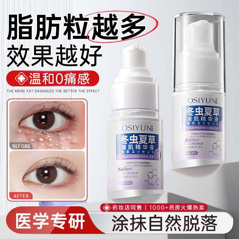 脂肪粒颗粒清肌眼部油脂粒眼角眼周闭口眼霜精华液祛汗管去除神器