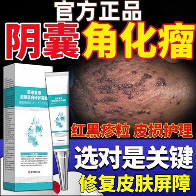 阴囊血管角化瘤黑红疙瘩蜘蛛痣红斑按压疼痛阴囊血泡红肿斑块