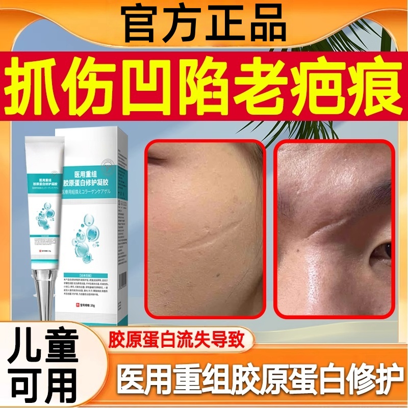 去疤膏抓伤生长因子修凹陷性面部划伤疤痕填充长肉复除疤祛疤膏
