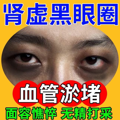 肾虚黑眼圈去除神器特别严重黑色素沉淀药房款膏强力血管型眼贴