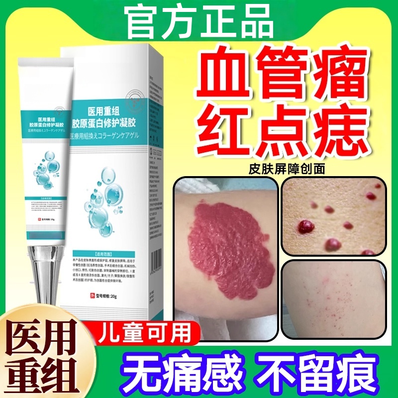 血管瘤血管痣凝胶专搭用蜘蛛痣去除膏官方正品