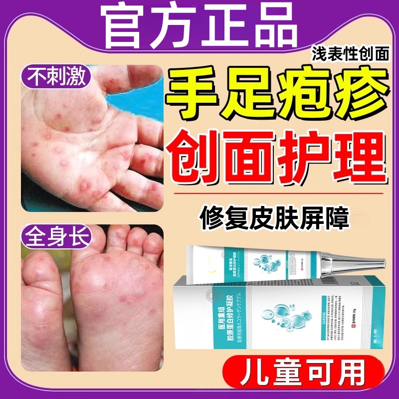 儿童手足口疱疹搭配喷剂a2b凝胶疱疹性药房同款喷雾