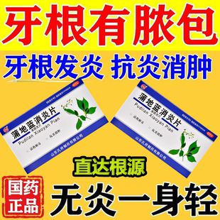 消炎药】牙根有脓牙根发炎红肿疼痛长脓包牙根尖脓肿蒲地蓝消炎片