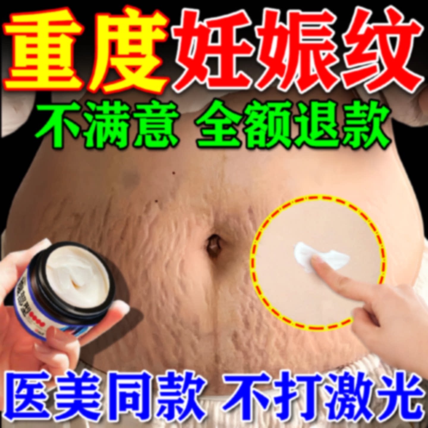 妊辰纹消除去妊娠纹非紧致肚皮非修复霜非淡化除疤痕膏遮盖旗舰店