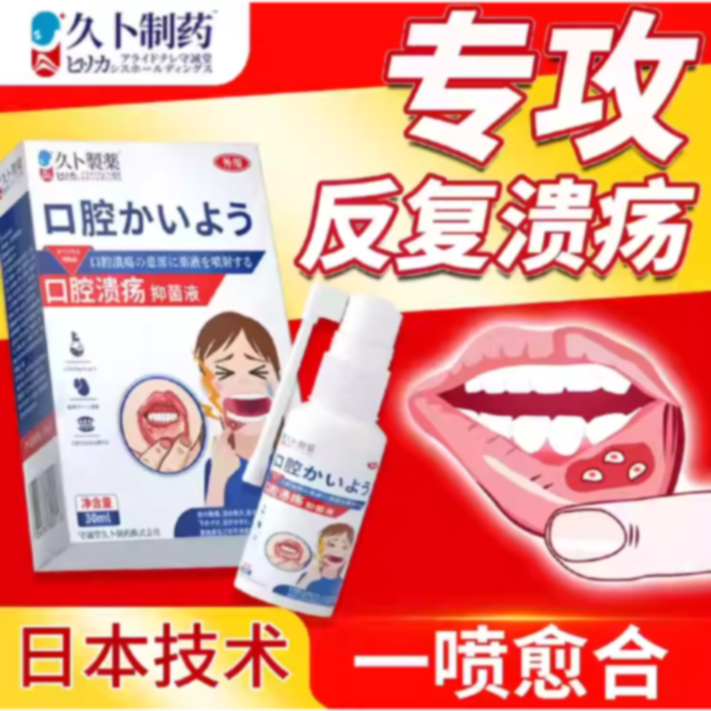久卜制药日本口腔溃疡喷雾嘴巴上火起泡长泡黏膜修复液旗舰店