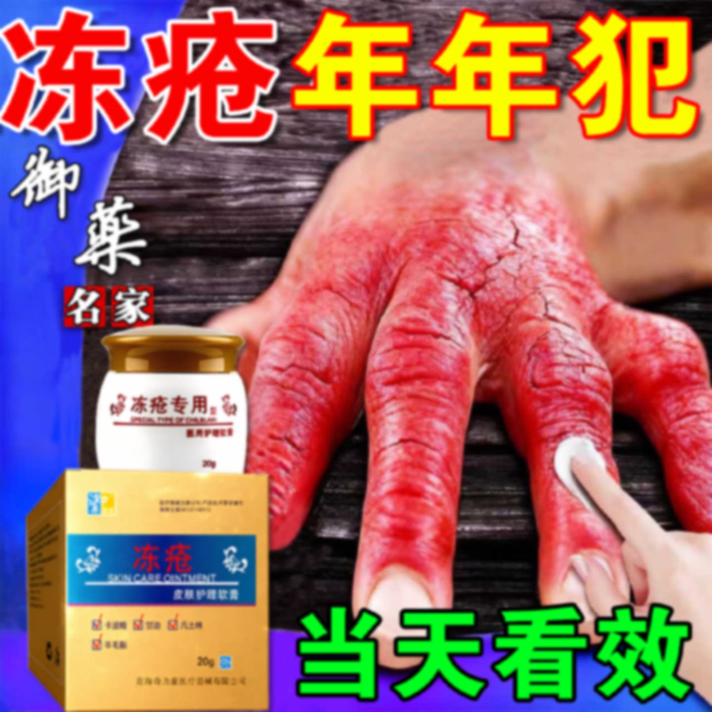 冻疮膏止痒冻伤护手霜特儿童效手足耳朵肿防冻防裂专用冻伤膏旗舰