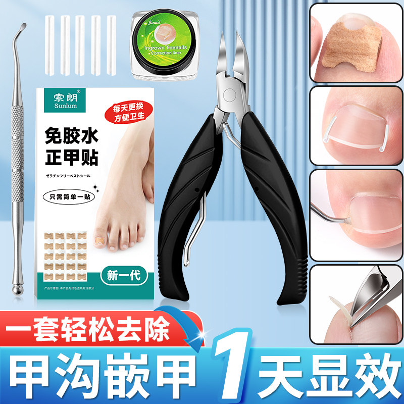 速发脚趾矫正器甲沟充用指甲剪刀嵌甲片垫脚指甲长肉里填专物鹰嘴