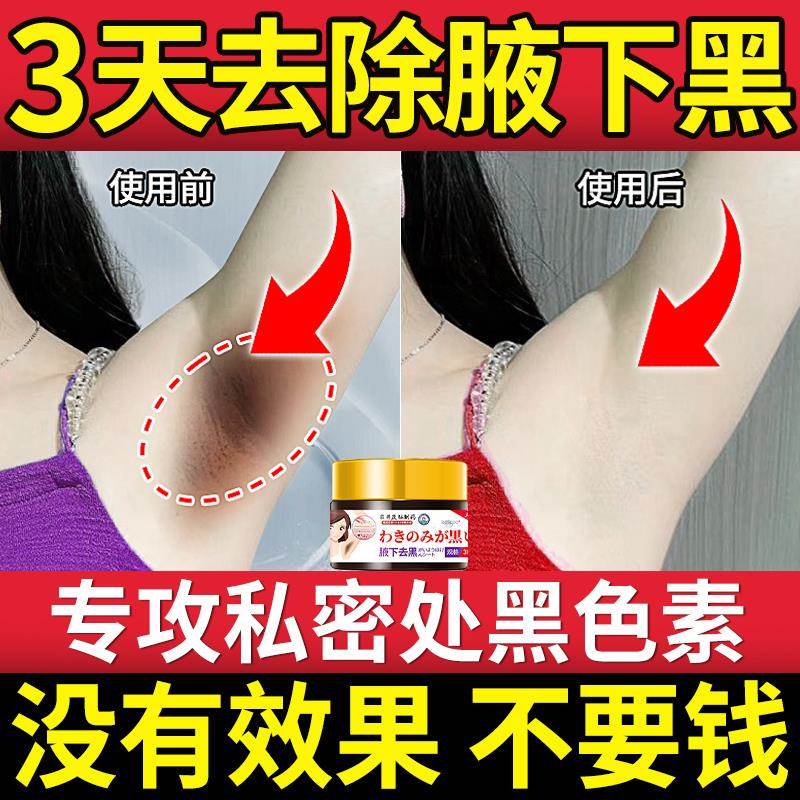 腋下去黑色素腋窝除黑美白祛淡化大腿内侧黑的沉淀脖子沉着磨砂膏