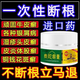 泰国进口治疗顽固牛皮癣藓鲜银屑病湿疹外用皮肤病头专用膏