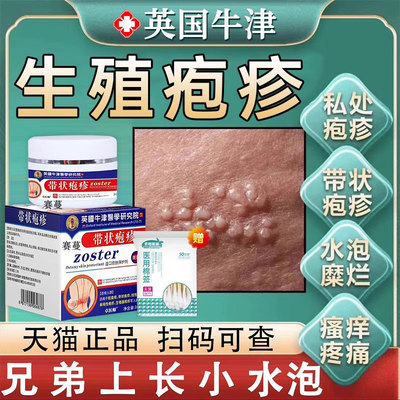 男士生殖器疱疹断根药疱立停克星治疗进口药根除中药膏真菌感染GX