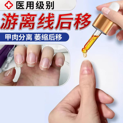 医用级指甲游离线萎缩空甲液