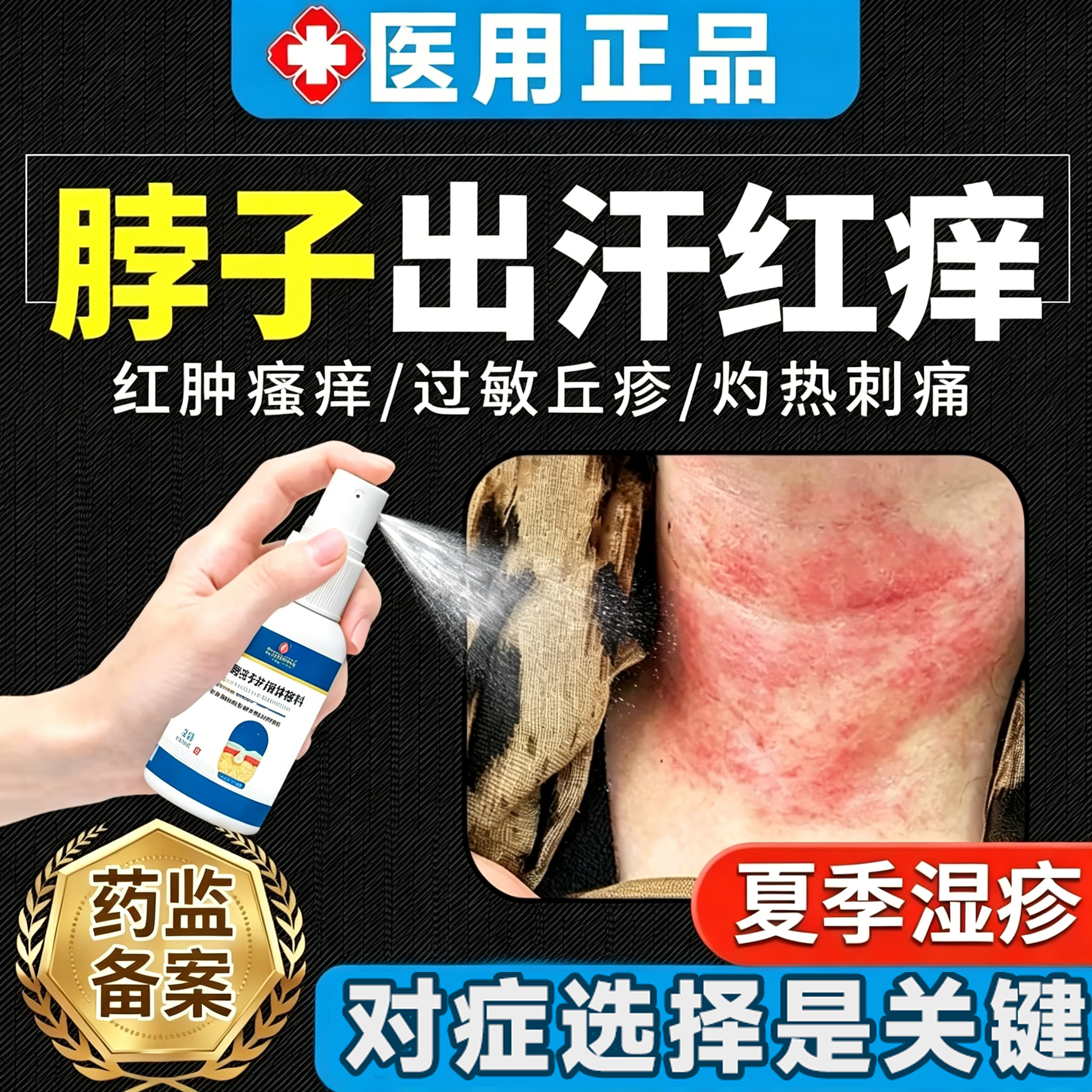 夏天脖子出汗红痒皮肤过敏湿疹止痒膏喷剂搭成人痱子粉防淹脖子LT