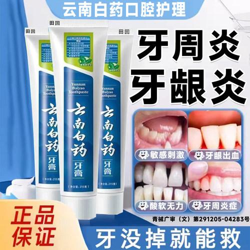 云南白药牙膏正品官方旗舰店治i牙周炎牙龈出血专用消i炎止痛LT