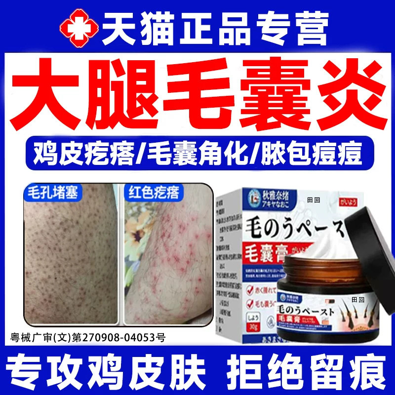 腿部毛囊炎鸡皮肤疙瘩毛囊角化症专药膏用去除全身手臂马拉色菌LT