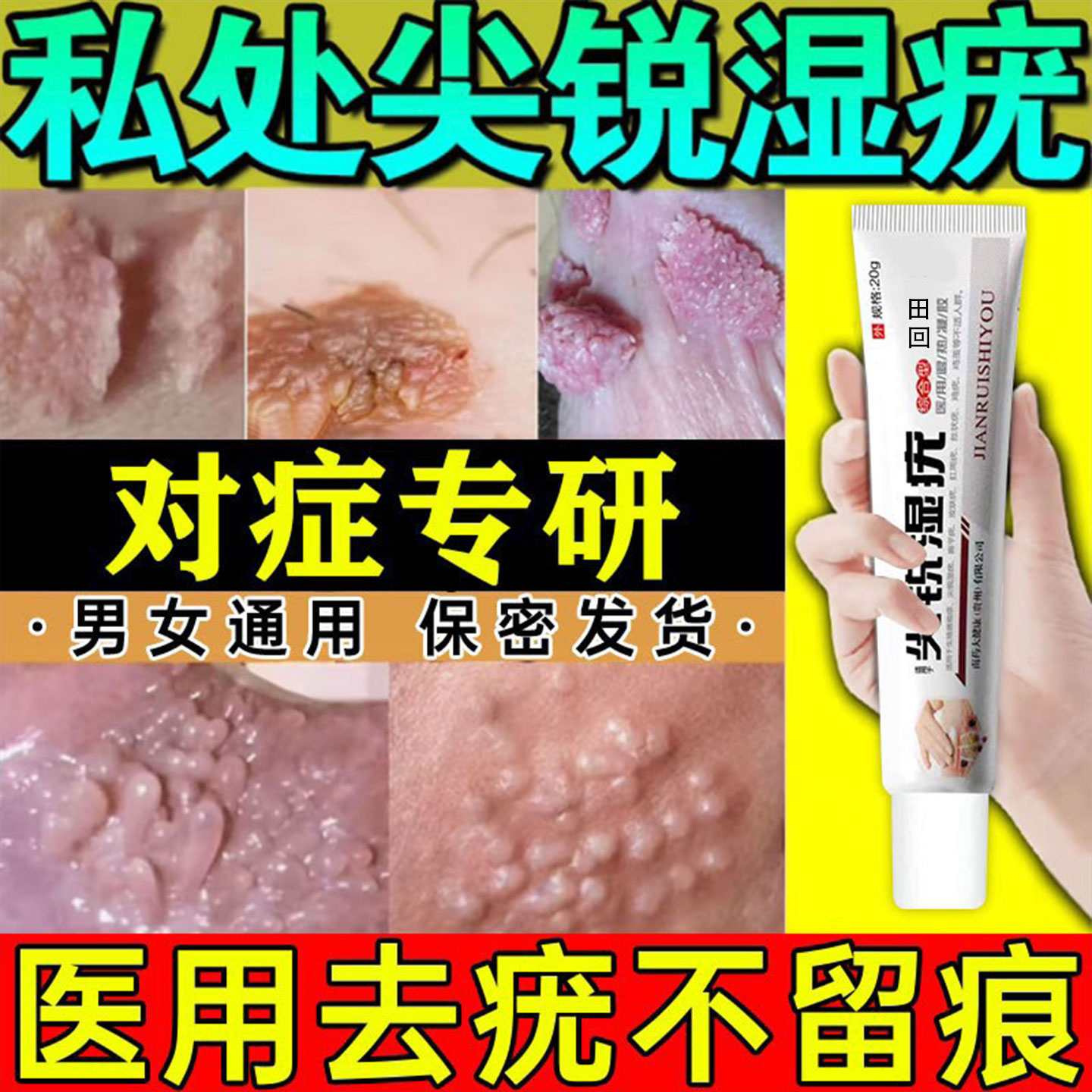 尖锐湿疣特效药重组人干扰素a2d软膏b2凝胶