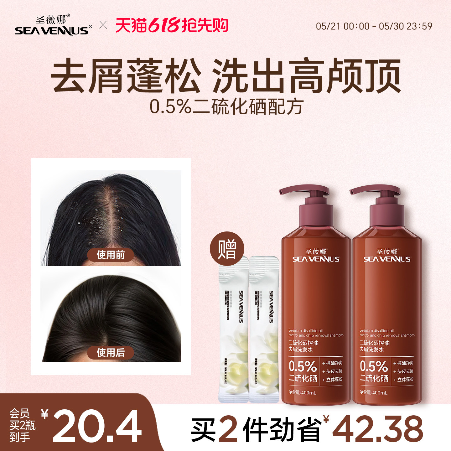 圣薇娜二硫化硒去油洗发水氨基酸控油蓬松去屑止痒去头皮屑洗发露