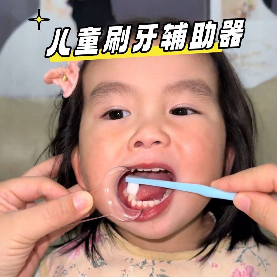 宝宝开口器辅助刷牙去污清洁