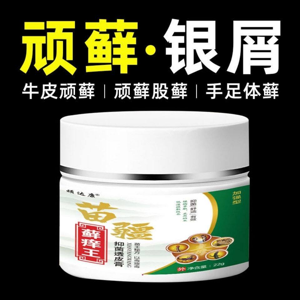 现货速发银屑手足癣止痒膏顽达康苗疆藓痒王透皮膏