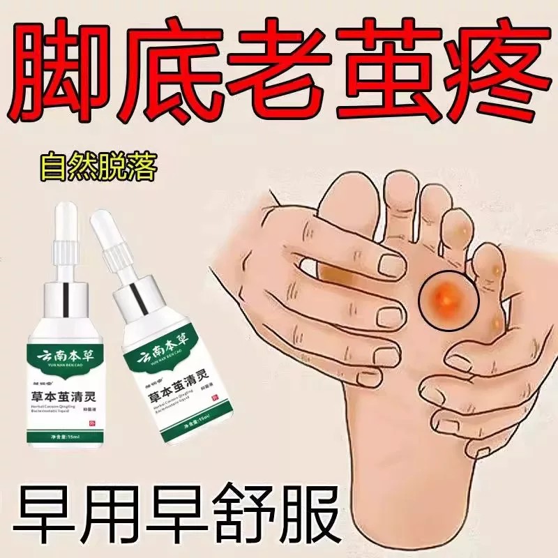 老茧手茧脚茧脚底手部茧净死皮根立硬软化剂脚垫非