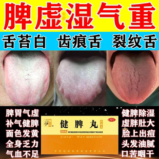 仲景健脾丸正品 脾胃虚弱拉肚子药舌苔发白健脾祛湿调理脾胃中成药
