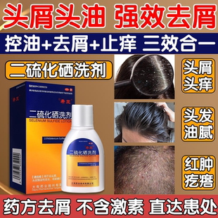 二硫化硒洗剂医用洗发水液去头皮屑脂溢性皮炎毛囊炎去油去屑止痒