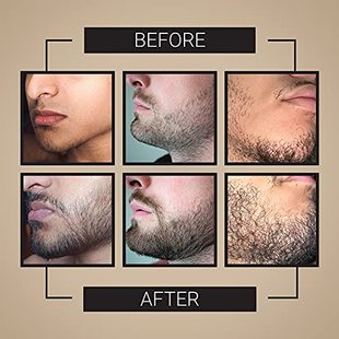 Growth Serum Kit Hair Beard