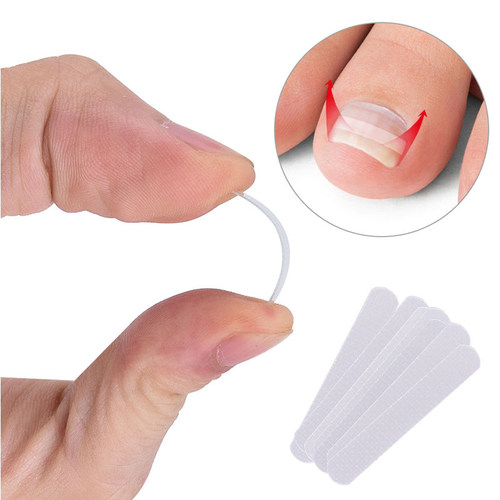 好货4-20PCS Nail Correction Stickers Paronychia Treatment