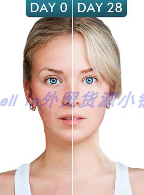 Retinol 3%Moisturizer Face Cream HyJaluronic Acid面霜视黄醇v