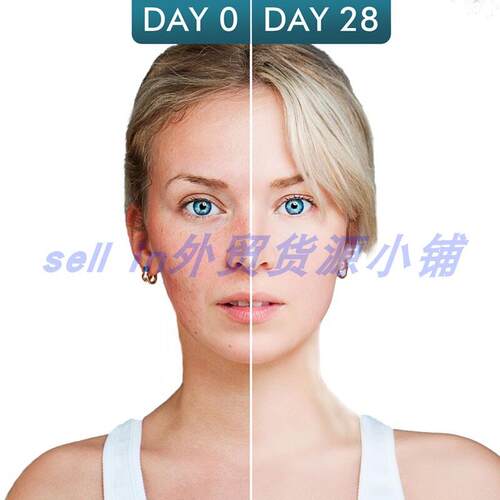 Retinol 3%Moisturizer Face Cream HyJaluronic Acid面霜视黄醇v