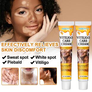 Vitiligo sweat spot wasrm spot and skin massage nursing crea