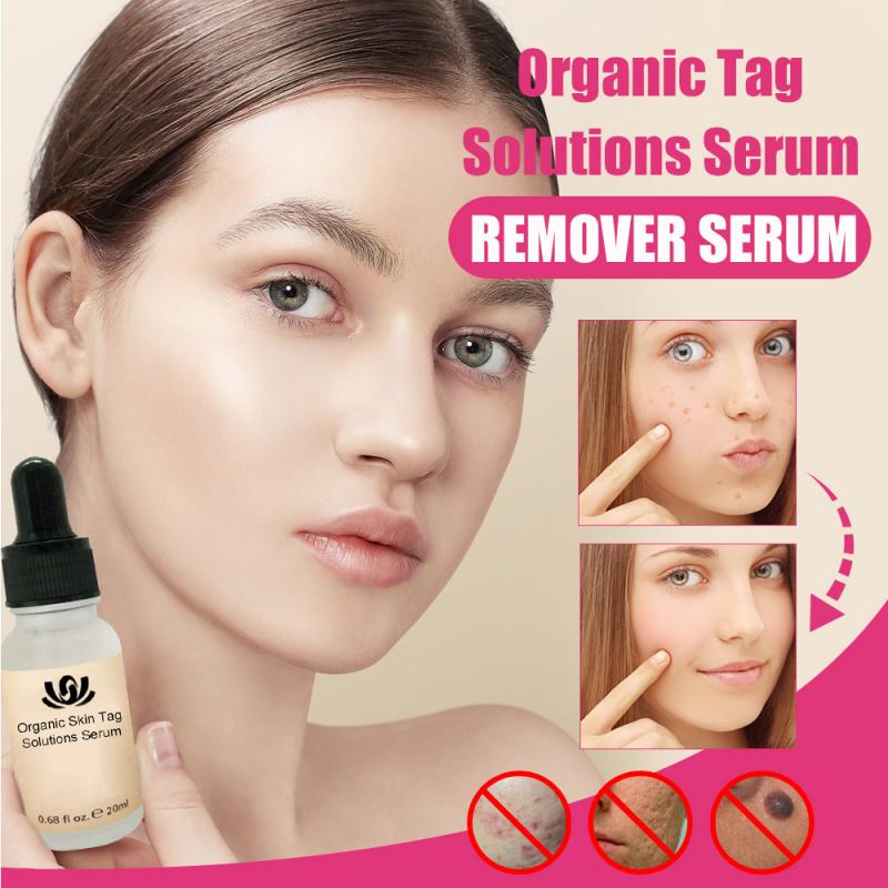 Organic Tags Solutions Serum 30g No Trace Painle Skin Tag Re