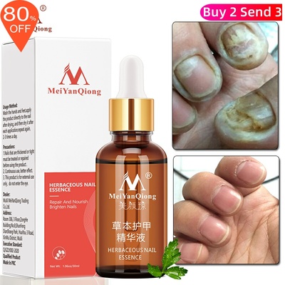 Fungal Nail Treatment Feet Care Essence Nail Foot Whitening